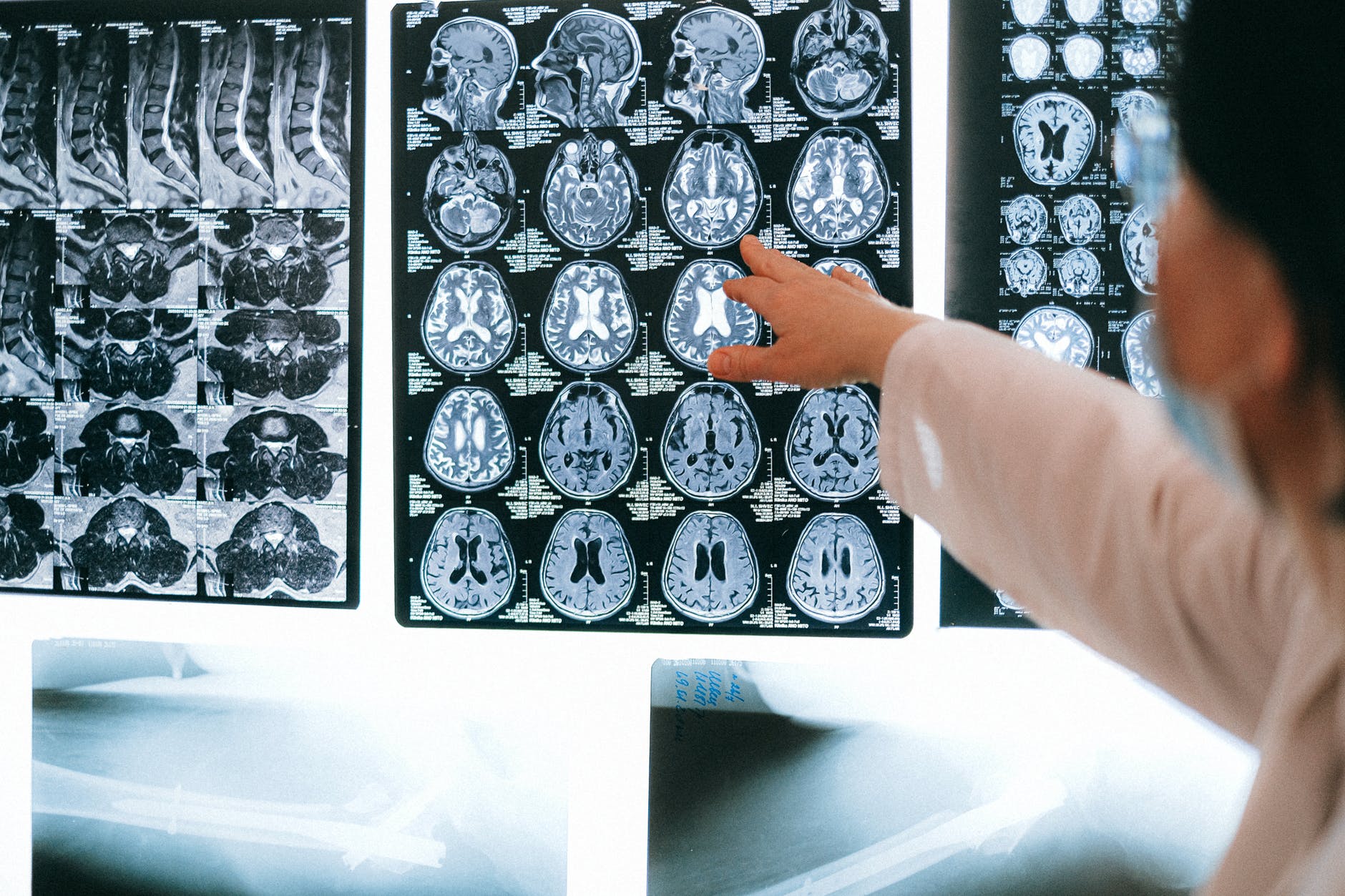  3 Tips for Paying for a Quality MRI